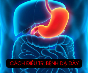 cách điều trị bệnh dạ dày